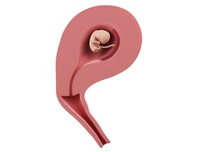 שבוע 9 להריון