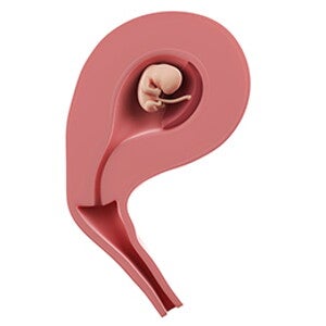 שבוע 9 להריון