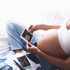 אישה בהריון מחזיקה תמונת אולטרה סאונד