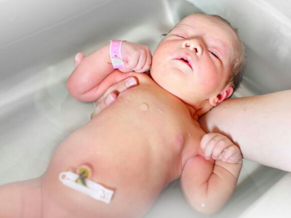 תינוק באמבטיה עם גדם בטבורו